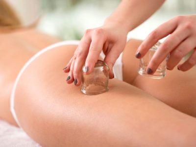 Cupping, coppette e massaggio per cellulite, drenare e rassodare