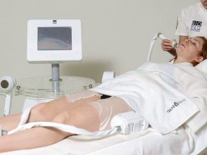 Criolipolisi, l’alternativa alla liposuzione -20% di grasso