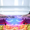 Cavitazione medica, con radiofrequenza