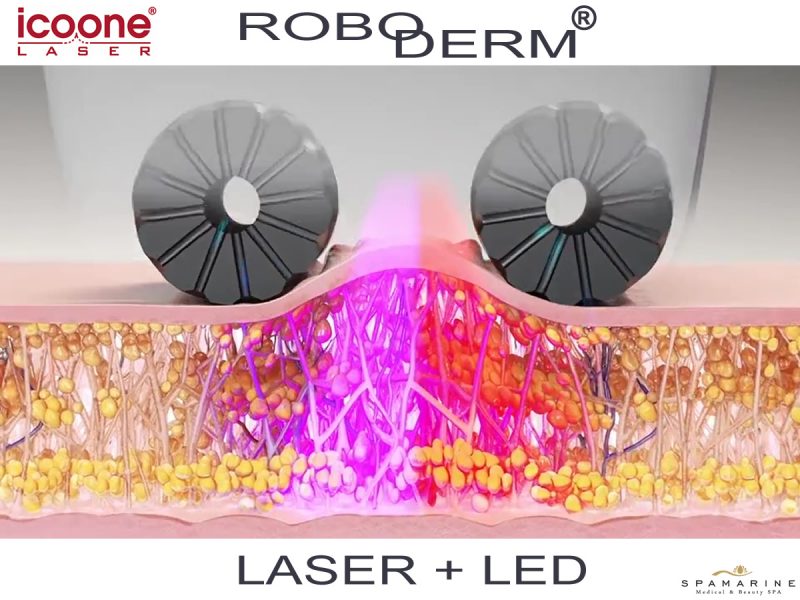 Icoone RoboDerm, stimolazione meccanica + Laser e Led