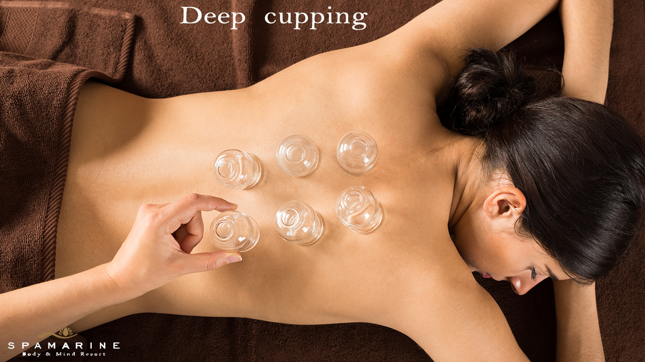 Deep cupping in offerta