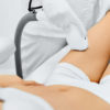Epilazioni laser donna