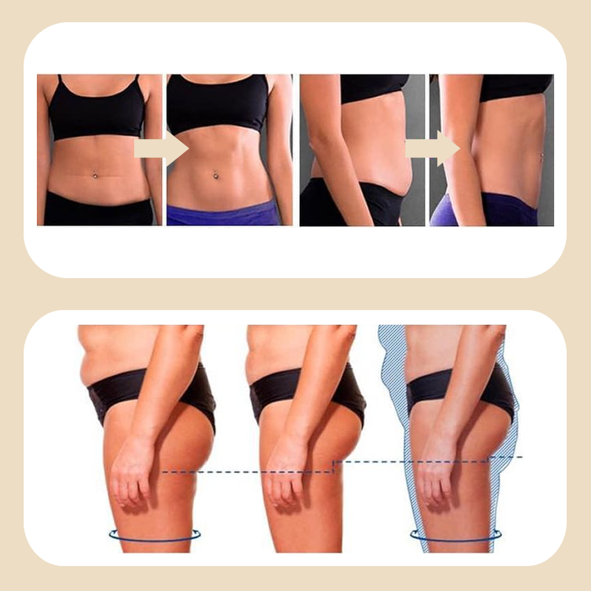 Modella il corpo Modella il corpo con MyTone