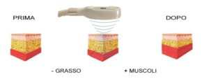 Aumentare il muscolo con MyTone