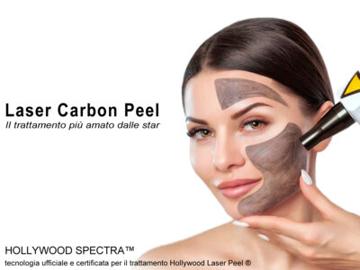 Trattamento Laser Carbon Peel