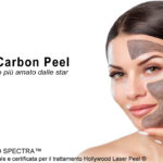 Trattamento Laser Carbon Peel