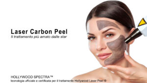 Trattamento Laser Carbon Peel