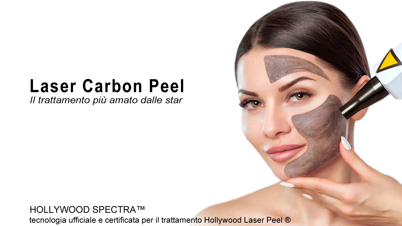 Carbon Peel Trattamento Laser Carbon Peel