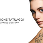 Trattamento Laser per la rimozione tatuaggi
