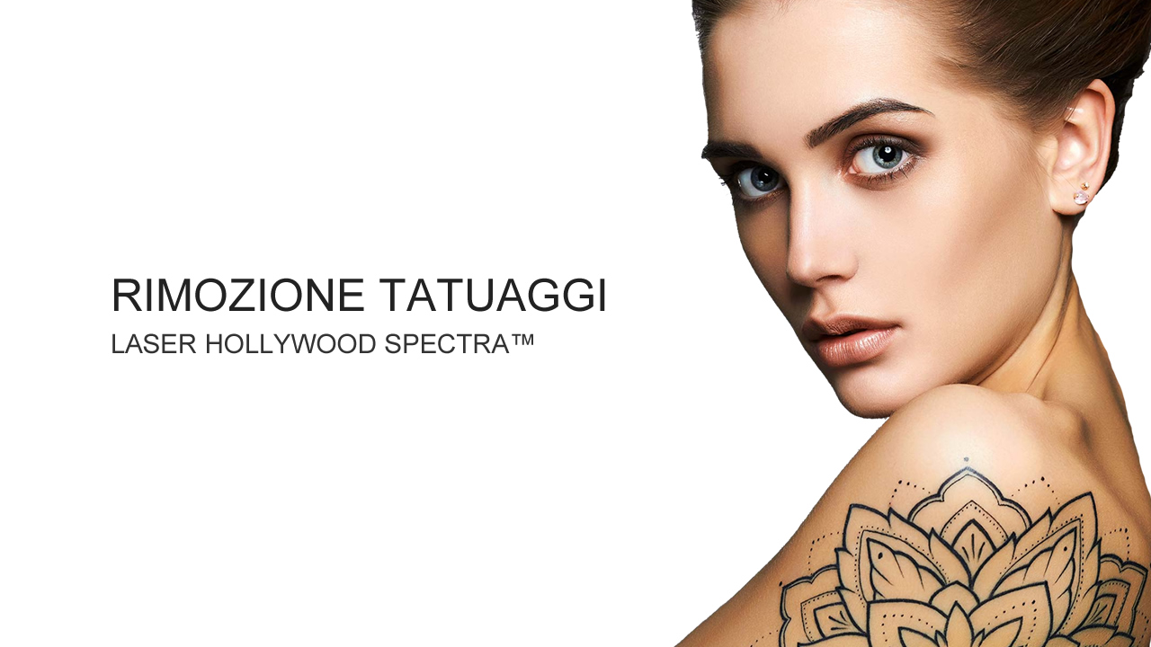 Rimozione tatuaggi Trattamento Laser per la rimozione tatuaggi
