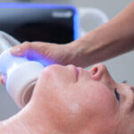 CryoDoubleChin riduzione doppio mento e tono