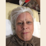 CryoLift viso CryoLift viso