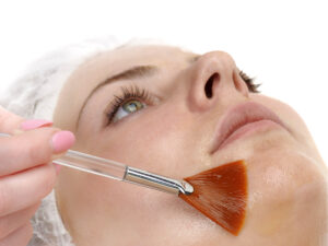 Peeling biorivitalizzante